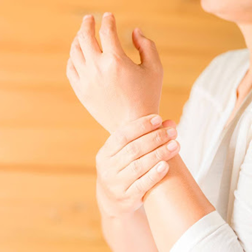 Carpal Tunnel Syndrome