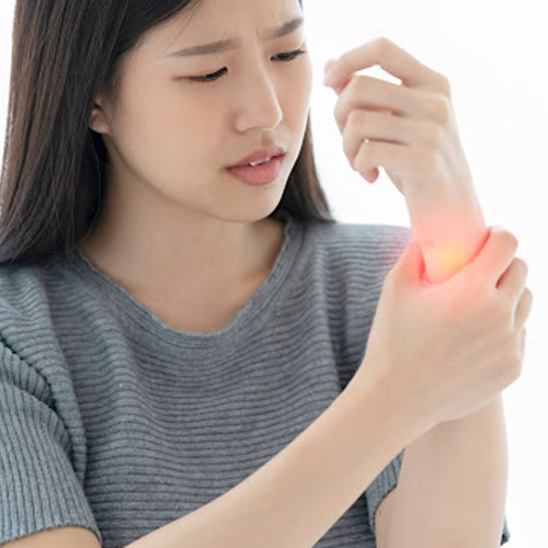 Definisi dan Penyebab Carpal Tunnel Syndrome